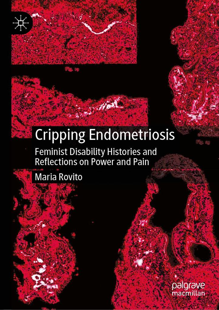 Produktbild: Cripping Endometriosis | Maria Rovito
