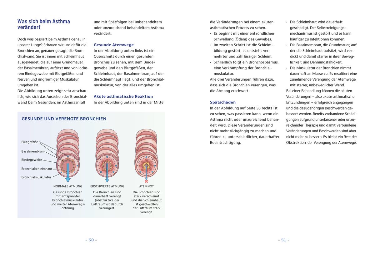 Weitere Ansicht: Besser leben mit Asthma und COPD | Thomas Hausen