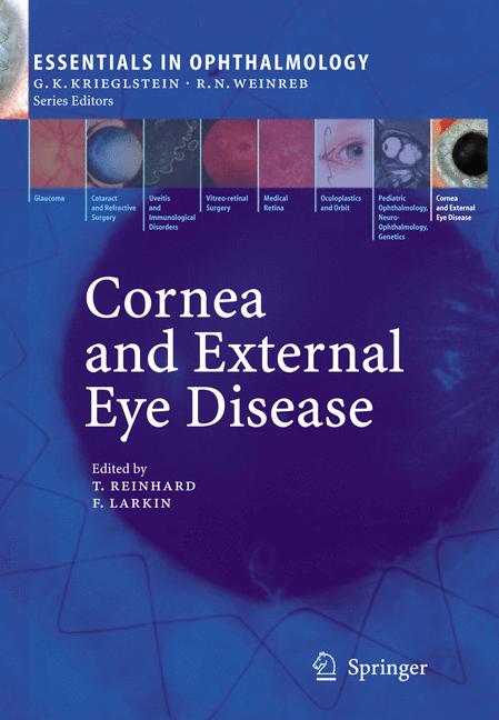 Weitere Ansicht: Cornea and External Eye Disease