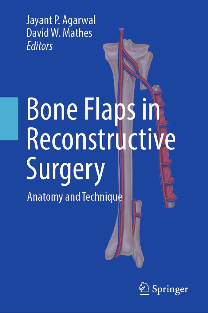 Produktbild: Bone Flaps in Reconstructive Surgery