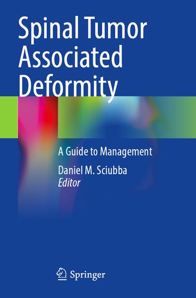 Produktbild: Spinal Tumor Associated Deformity