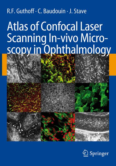 Weitere Ansicht: Atlas of Confocal Laser Scanning In-vivo Microscopy in Ophthalmology | R.F. Guthoff, C. Baudouin, J. Stave
