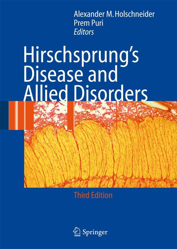 Produktbild: Hirschsprung's Disease and Allied Disorders