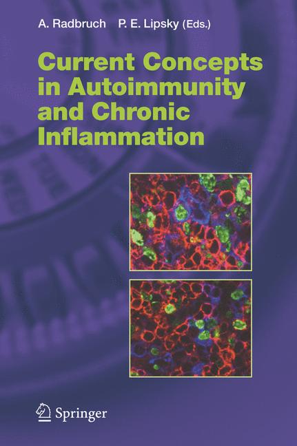 Weitere Ansicht: Current Concepts in Autoimmunity and Chronic Inflammation