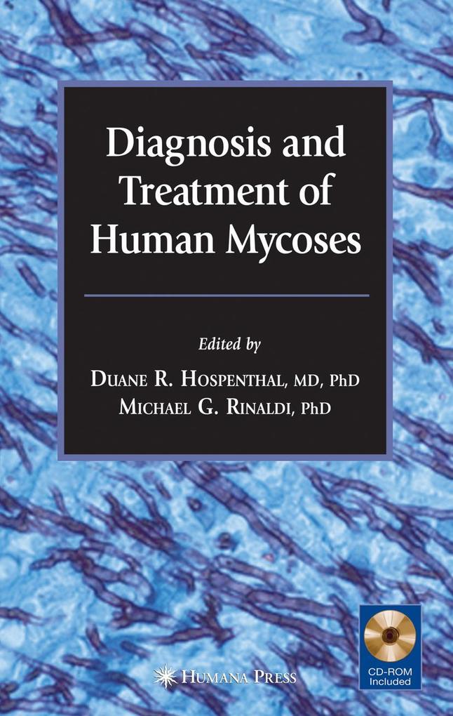 Produktbild: Diagnosis and Treatment of Human Mycoses