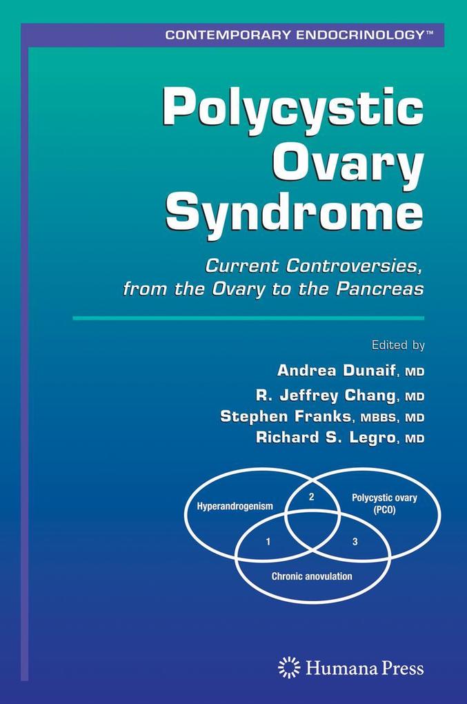 Produktbild: Polycystic Ovary Syndrome