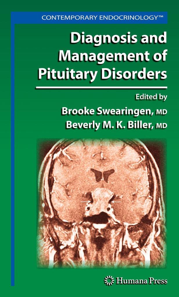 Produktbild: Diagnosis and Management of Pituitary Disorders