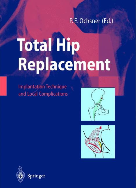 Weitere Ansicht: Total Hip Replacement