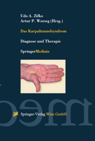 Produktbild: Das Karpaltunnelsyndrom