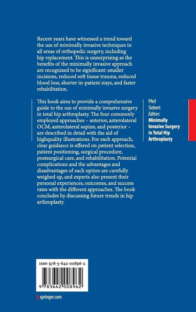 Weitere Ansicht: Minimally Invasive Surgery in Total Hip Arthroplasty